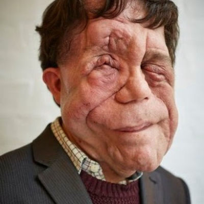 adam-pearson